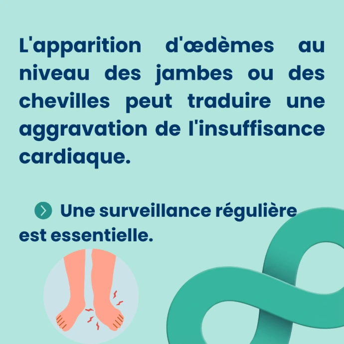 OEDEMES AU NIVEAU DES JAMBES
